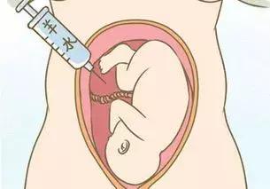 羊水穿刺多重要？医生：这几类孕妈最好做！