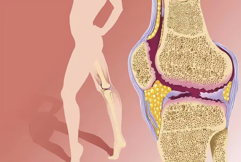 腰腿痛病因病机是什么,腰腿痛的病因全在这里了