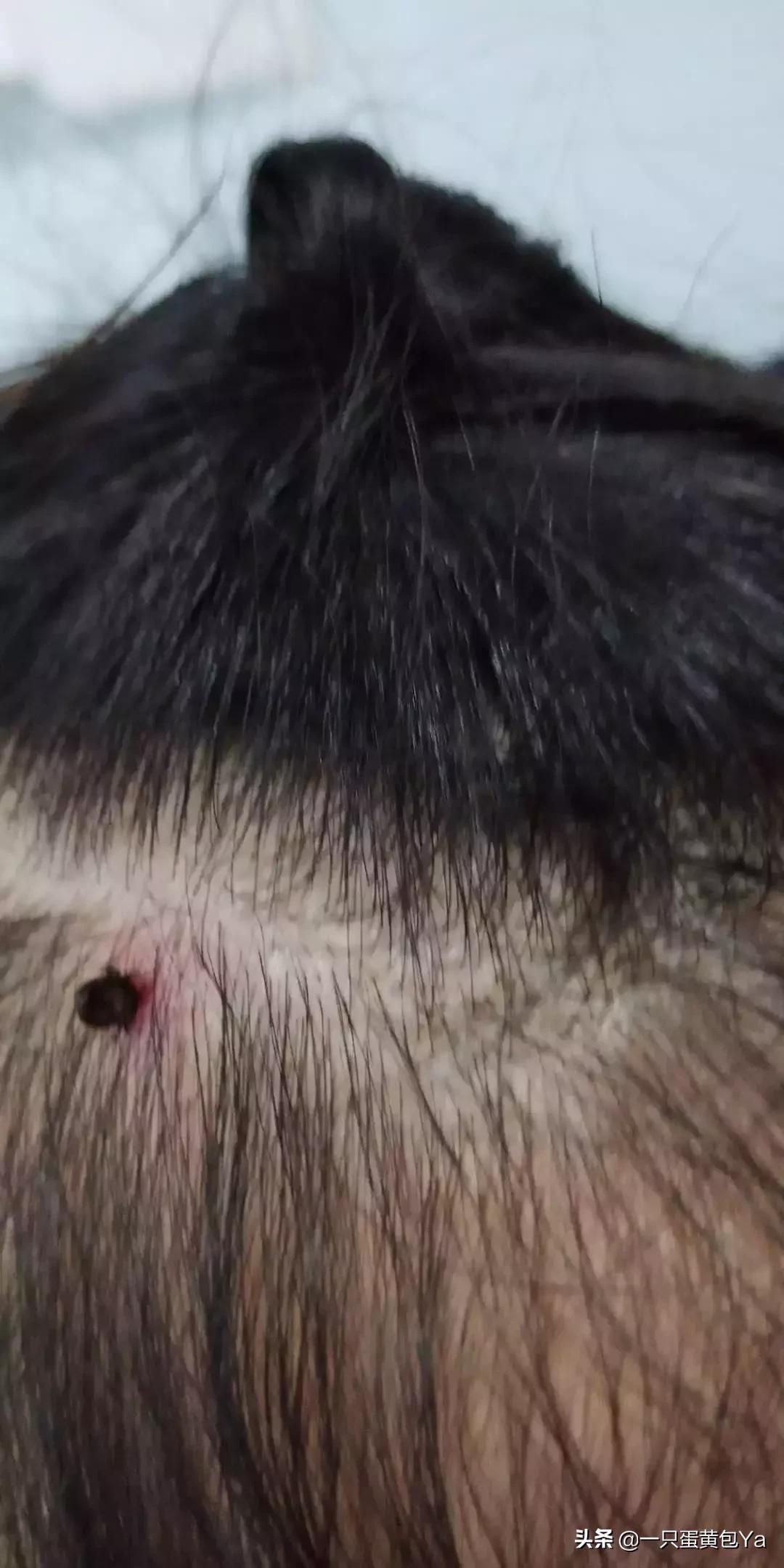 儿童头部起小疙瘩是怎么回事,小孩头上长红疙瘩像被虫咬的一样