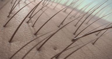 头发毛躁并且脱发推荐洗发水,用什么洗发水改善头皮脱发