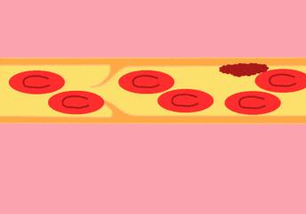 大姨妈颜色呈泥土色,大姨妈颜色什么样的算正常