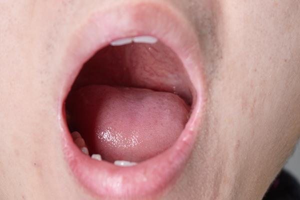 不管怎么刷牙都有口臭怎么办,没有刷牙如何快速清除口臭