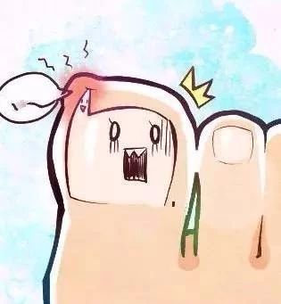 甲沟炎和糖尿病有关吗,糖尿病甲沟炎是糖尿病足吗