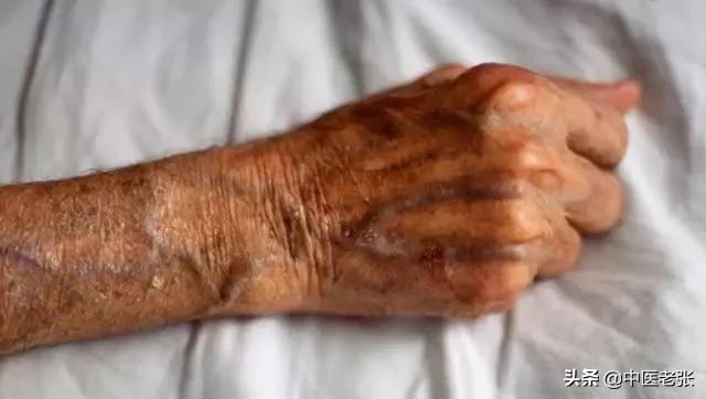 老人身上为什么总有股“老人味”？牢记这两个方法，不怕被人嫌弃