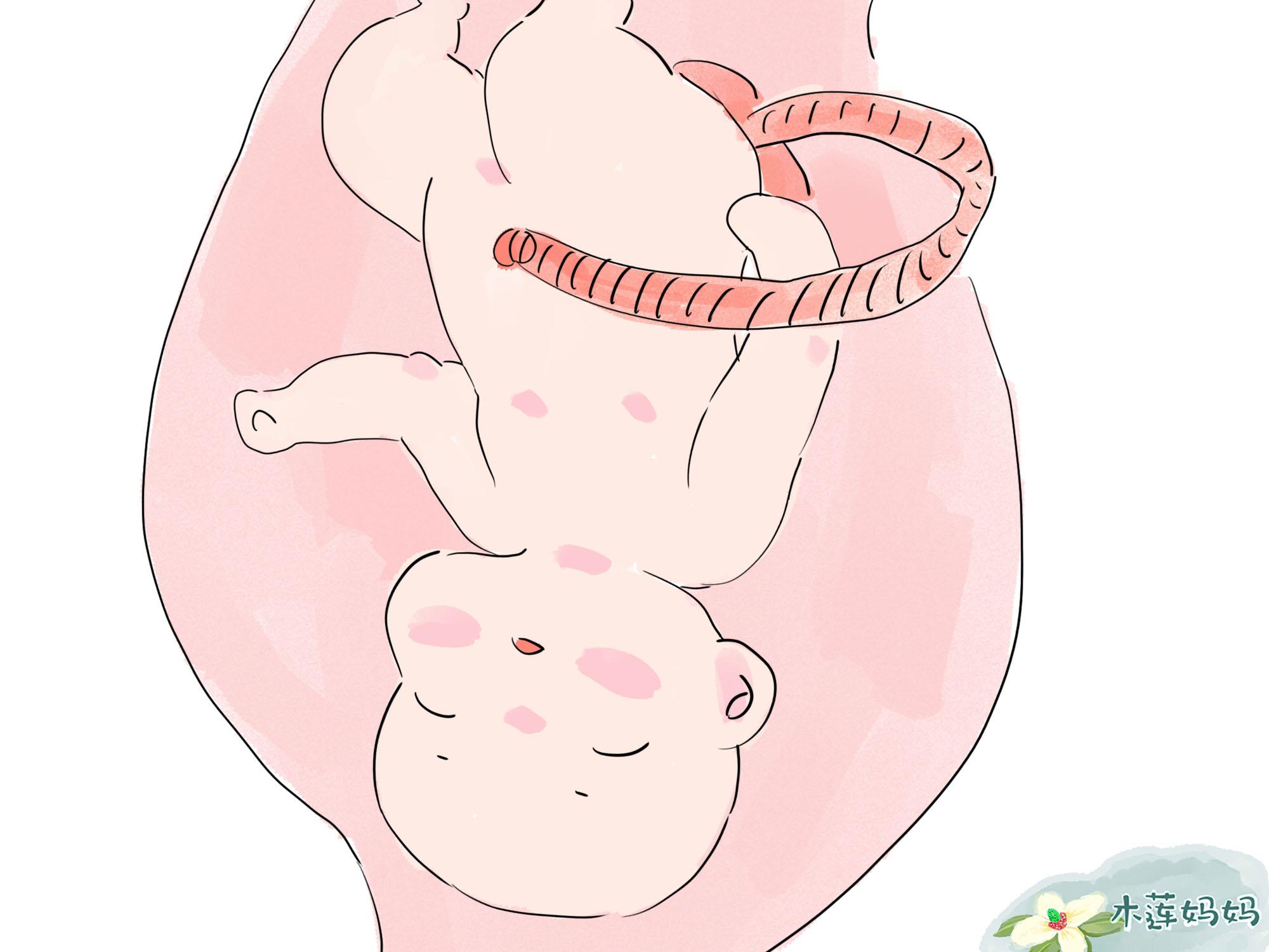 胎儿的粪便如何处理,胎儿的排泄物怎么排出来