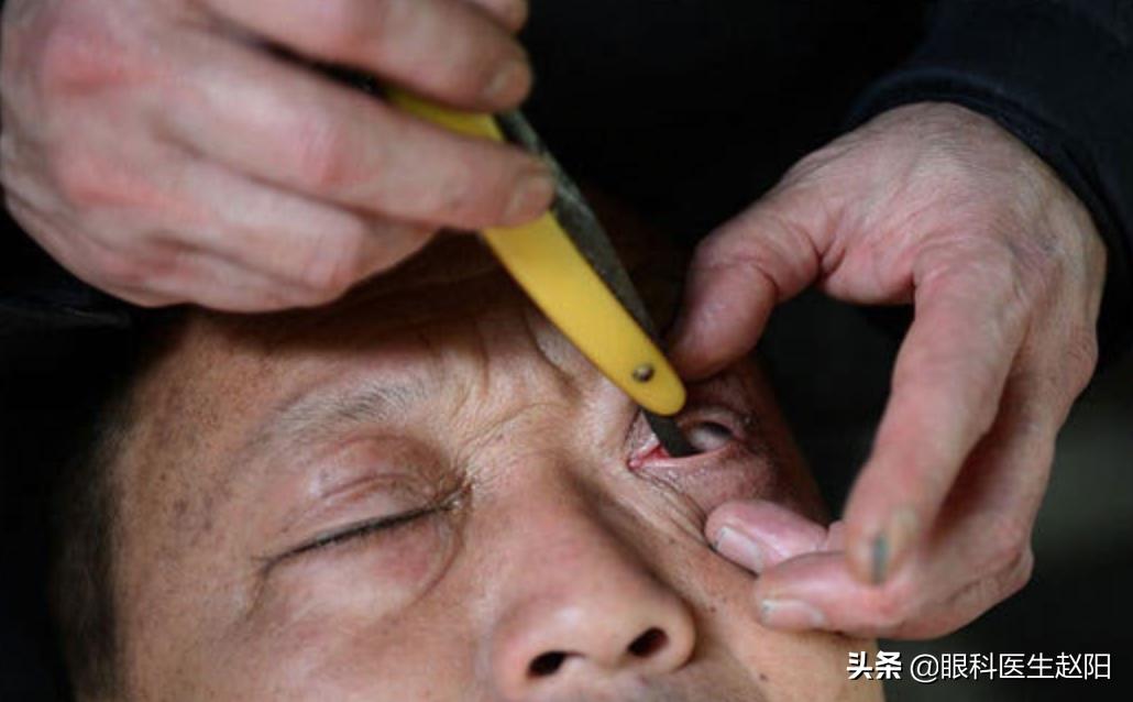 阿井水、淘米水、刀锋洗眼…千奇百怪的“洗眼”神操作你见过吗？