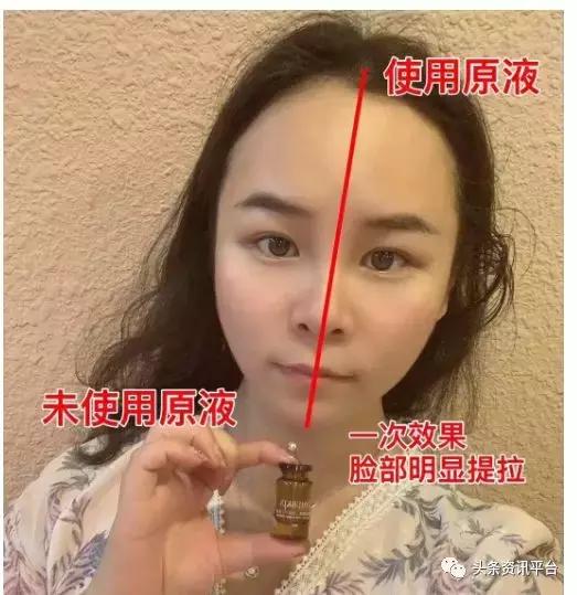 从优源生物、易纤福到自立门户，肤瑟到头来只是在效仿网红世家？