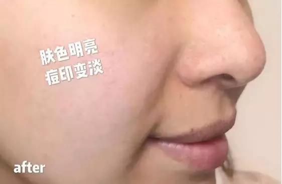 美白祛黄提亮肤色泡水喝,每天喝一杯可以美白淡斑清热解毒