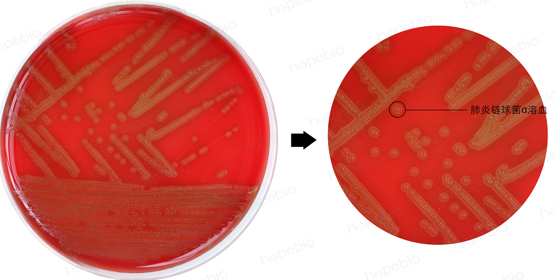 细菌溶血实验步骤,细菌革兰染色实验报告