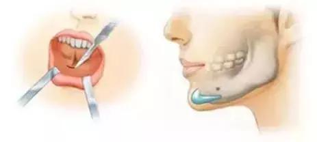 化妆真的能完全遮住瑕疵吗,化妆也掩盖不了岁月的痕迹