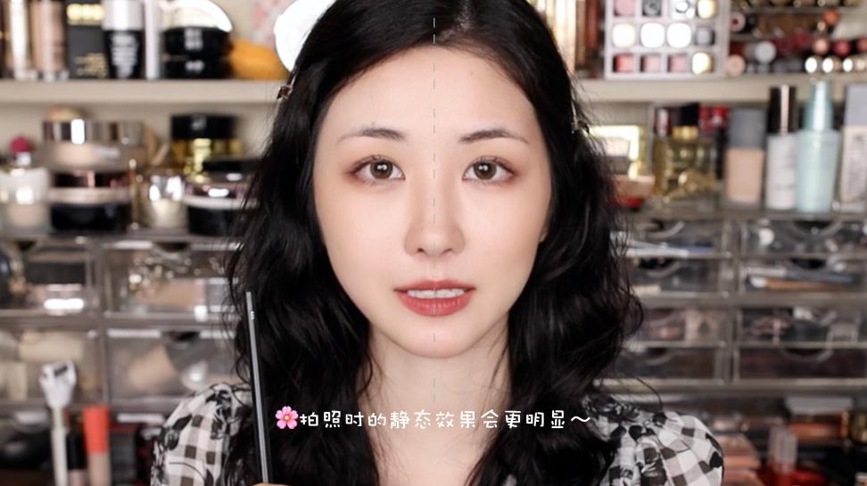 颧骨颧弓整容,颧骨高嘴凸面中凹整容