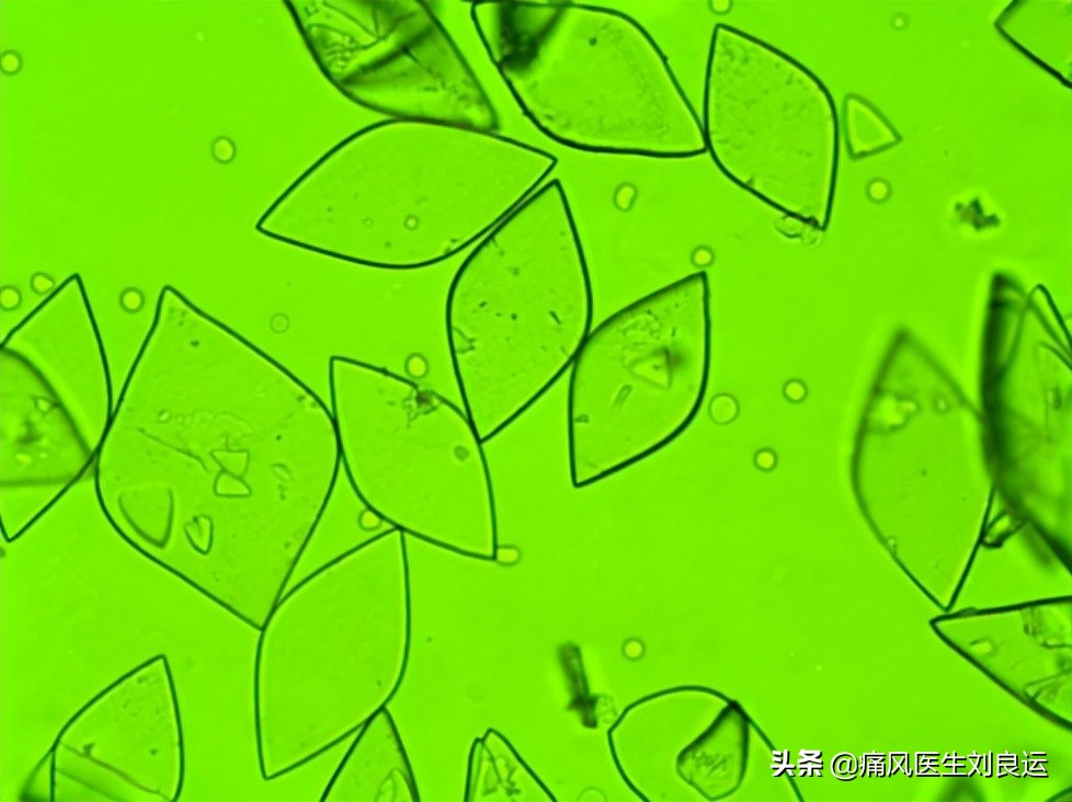 痛风患者吃降尿酸药要吃多久,痛风停药后尿酸正常