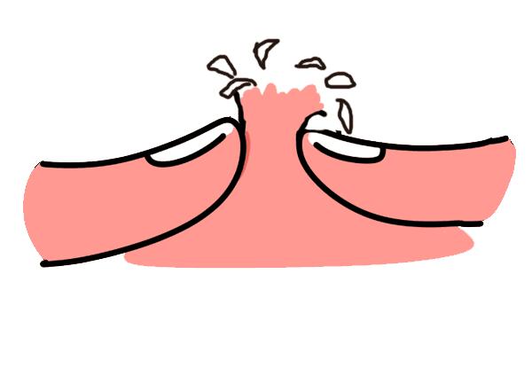 脸上闭口要怎么处理才会好,脸部闭口怎么彻底解决