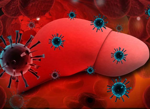 怎么判断痣是癌变还是普通痣,皮肤上长红痣要当心是肝病的征兆