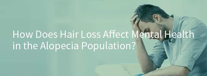 锻炼治斑秃,运动斑秃