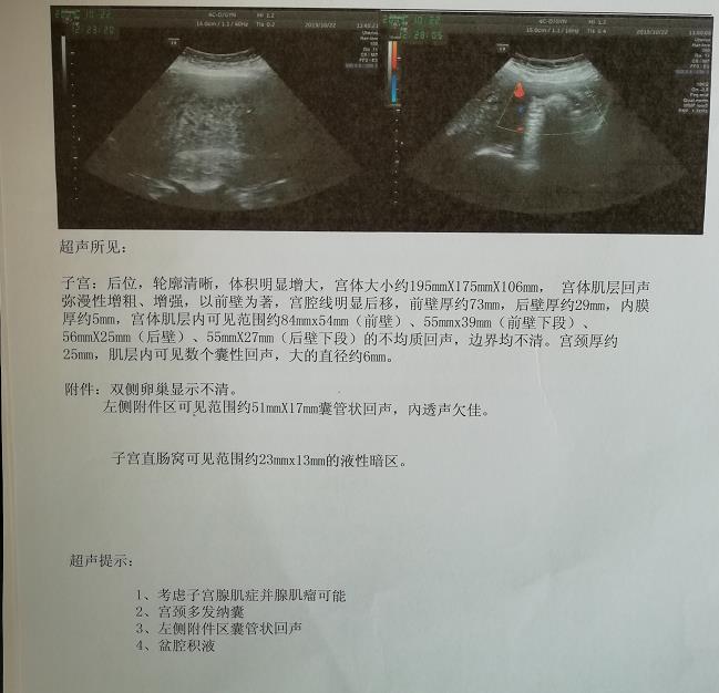 原发性痛经非常剧烈,痛经12级怎么办