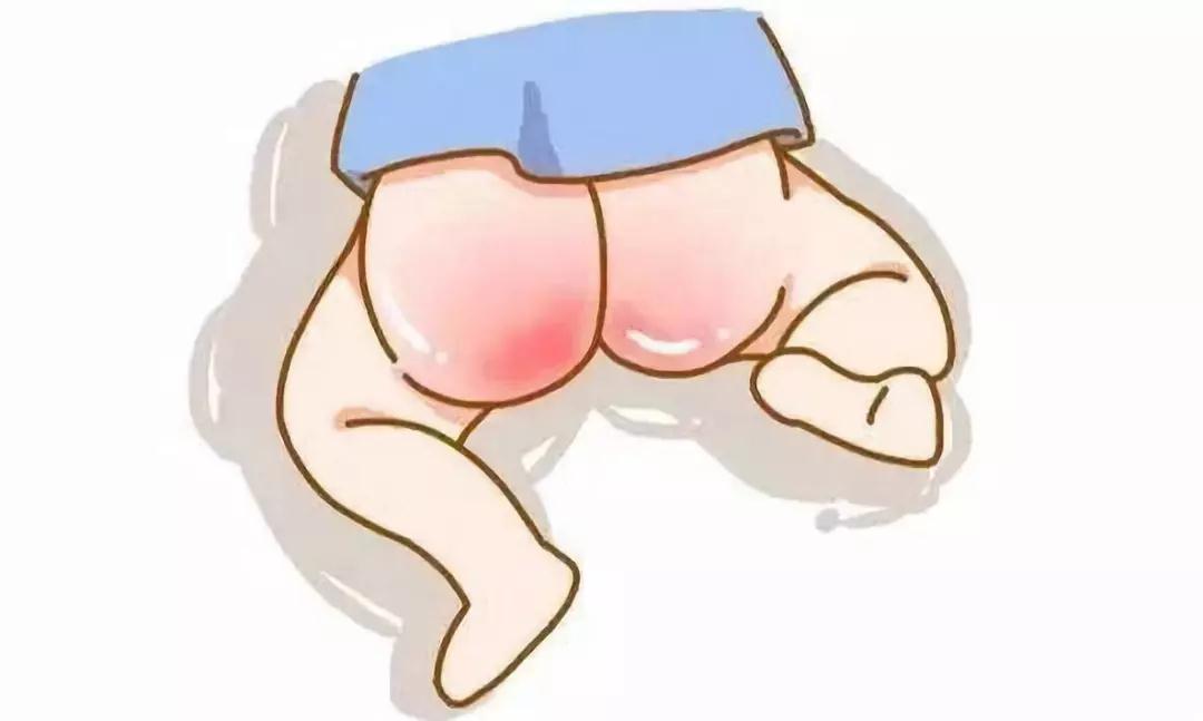 肛门潮湿是怎么回事男性用什么药,肛门瘙痒是什么原因