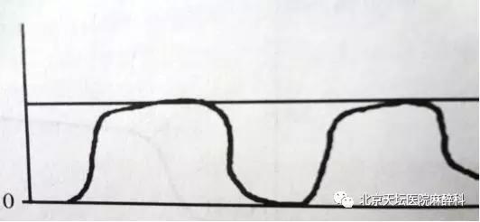 常见呼吸类型有哪几种,呼吸少量二氧化碳有什么症状