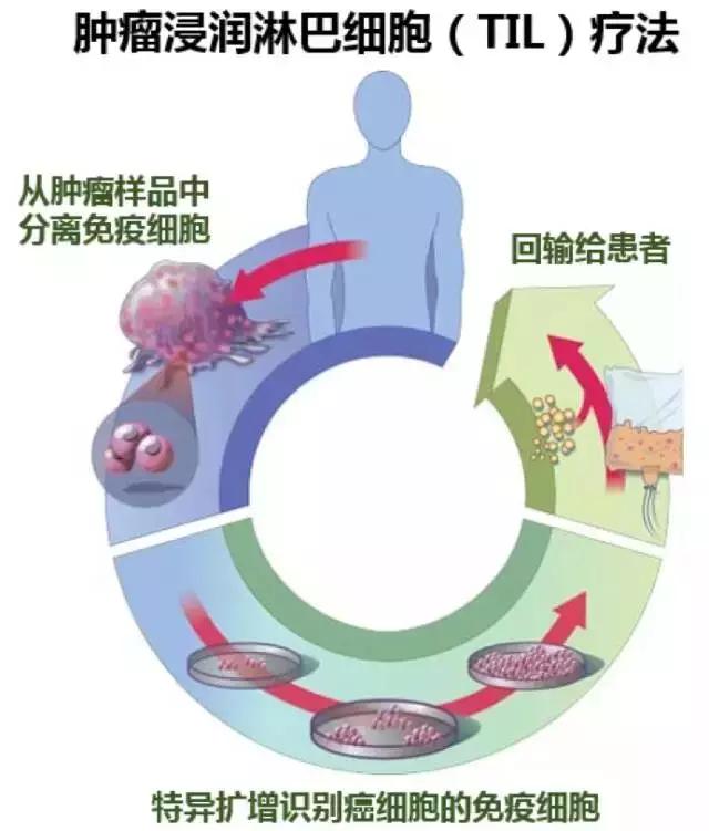 子宫癌早期需要做割子宫手术吗,子宫癌症可以治愈吗
