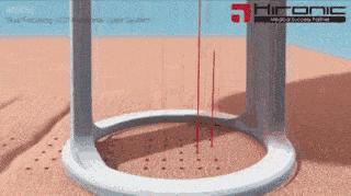 关于激光美容的几个误区你知道吗,走出激光美容的10个误区