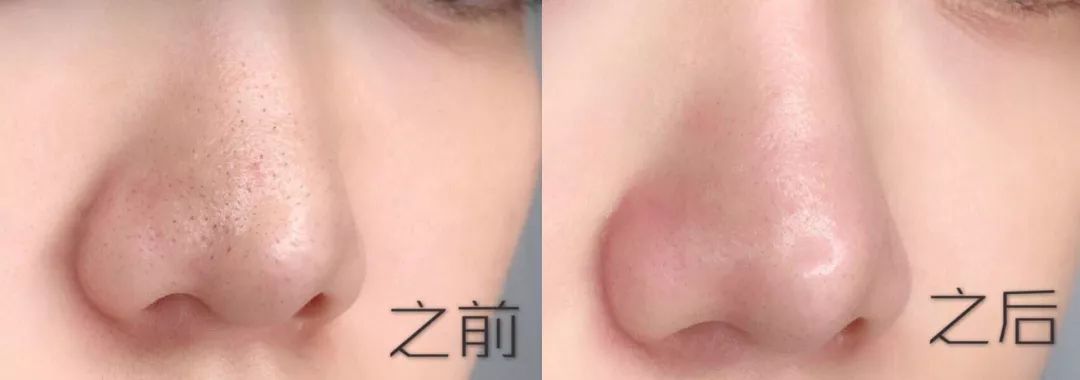 好用不起痘的洗面奶推荐,长期使用祛黑头洗面奶推荐