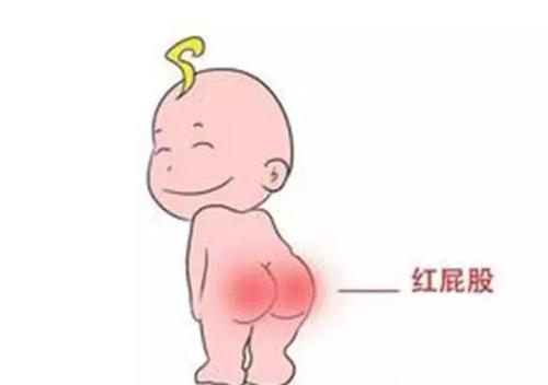 15天的新生儿屁股红怎么办,宝妈屁股疼怎么办