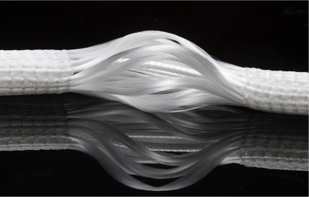 膝关节前叉韧带损伤最佳恢复方法,膝关节前韧带断了必须手术吗