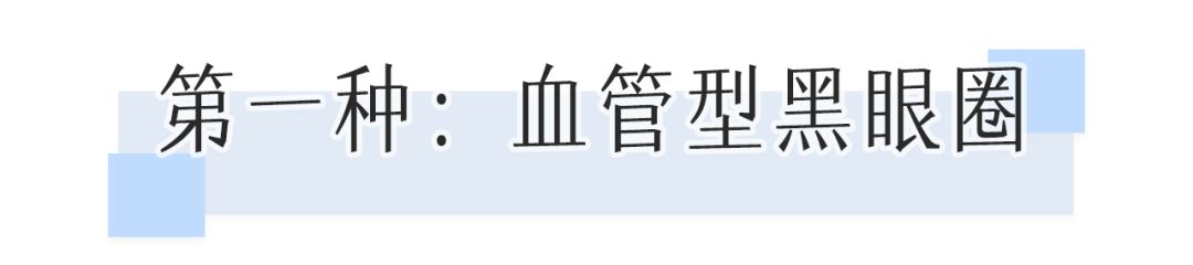 一次就能让黑眼圈消失的办法,一针下去瞬间没了黑眼圈