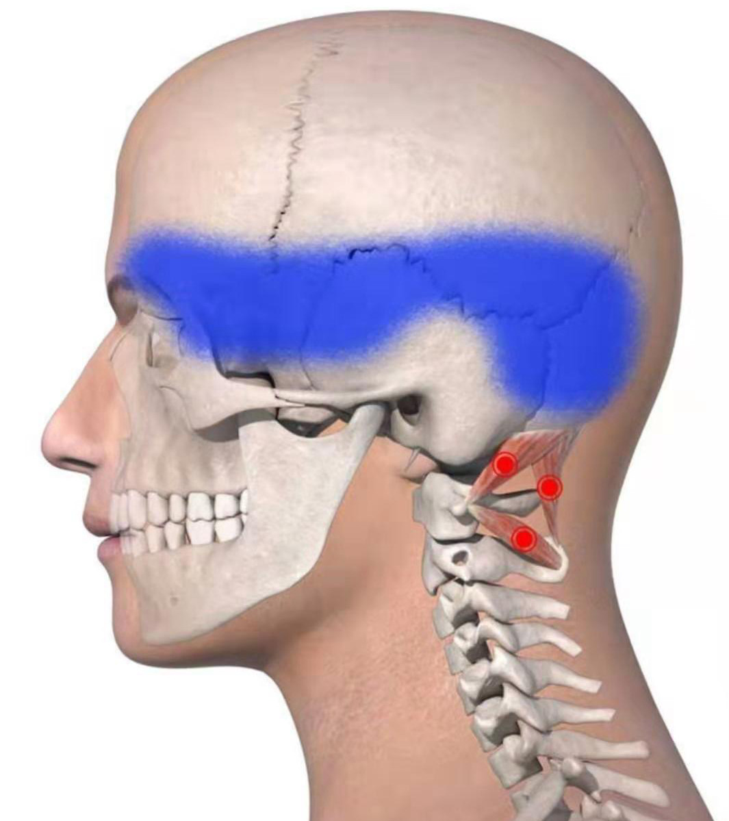他有颈椎病，头痛，像戴着紧箍咒，一个老头教他头画“凤凰”……