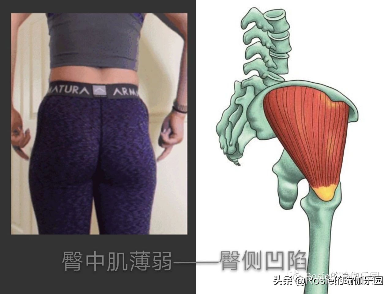 真翘臀和假翘臀怎么辨别,怎样判断翘臀是不是假的