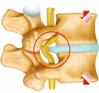 总是腰痛需不需要治疗,总是莫名腰疼