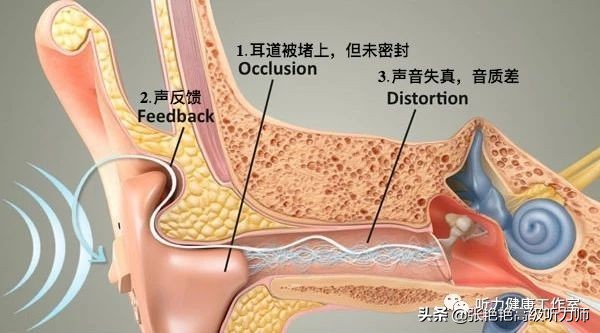 戴助听器说不清话,助听器有时听不好怎么办