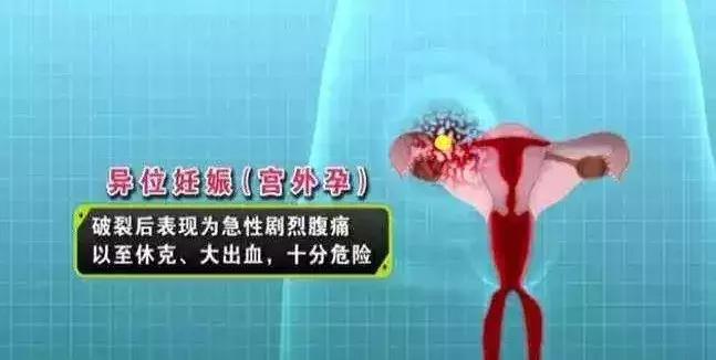 千万不要拿生命去发生性关系！这些3·8女神节的病例敲响警钟！