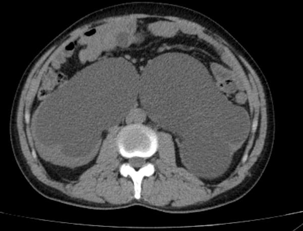 omg鑴傝偑,omg涓轰粈涔堥暱鑴傝偑