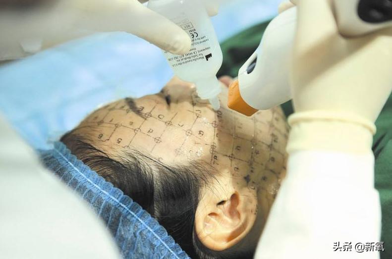 自嘲整容,承认整容七年的姐姐