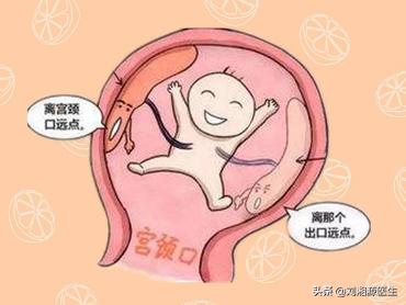 免疫问题怀孕必须保胎吗,免疫不良妊娠怎么检查