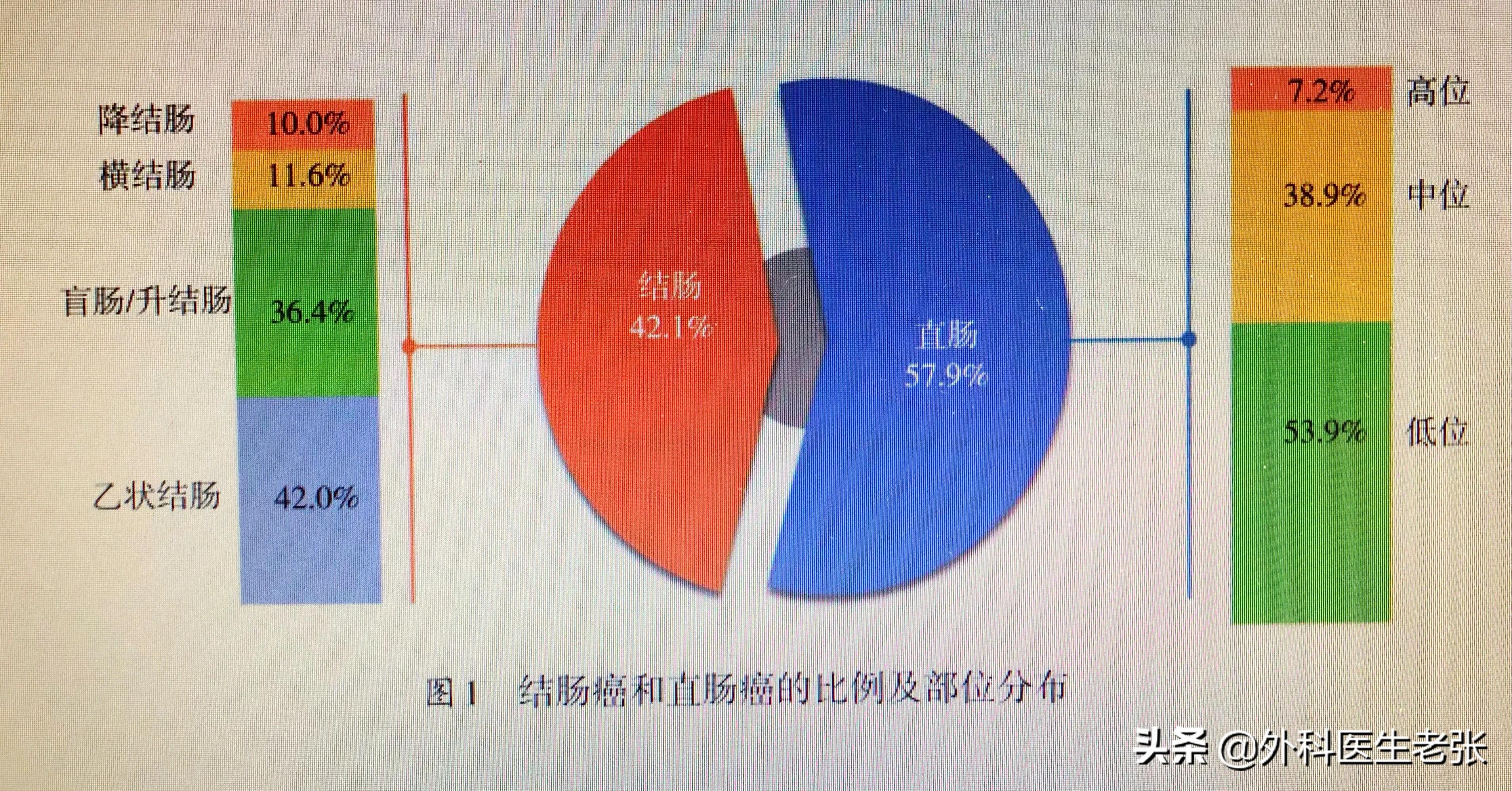 肛肠科医生检查痔疮多少钱,直肠癌免费检查