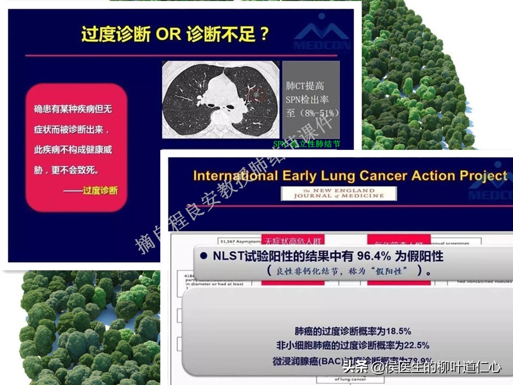 肺结节0.8厘米需手术吗,肺结节0期能治好吗