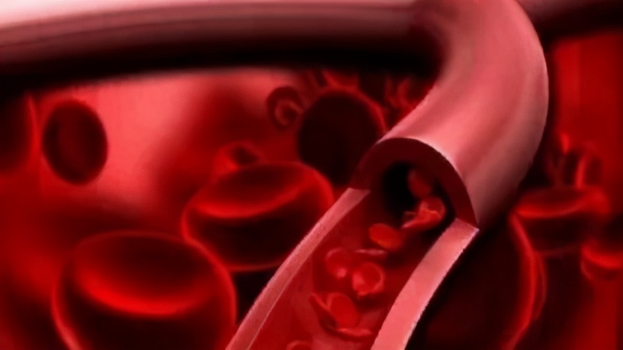 血小板减少吃白萝卜有好处吗,血小板减少吃什么食物最好