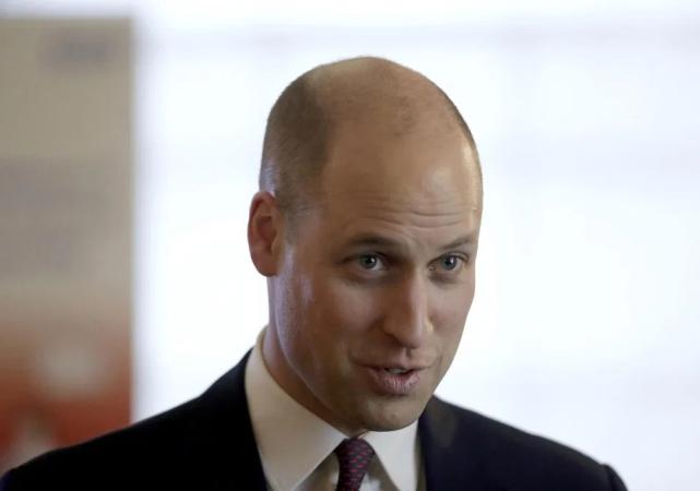 贝克汉姆头发为什么秃,贝克汉姆秃子