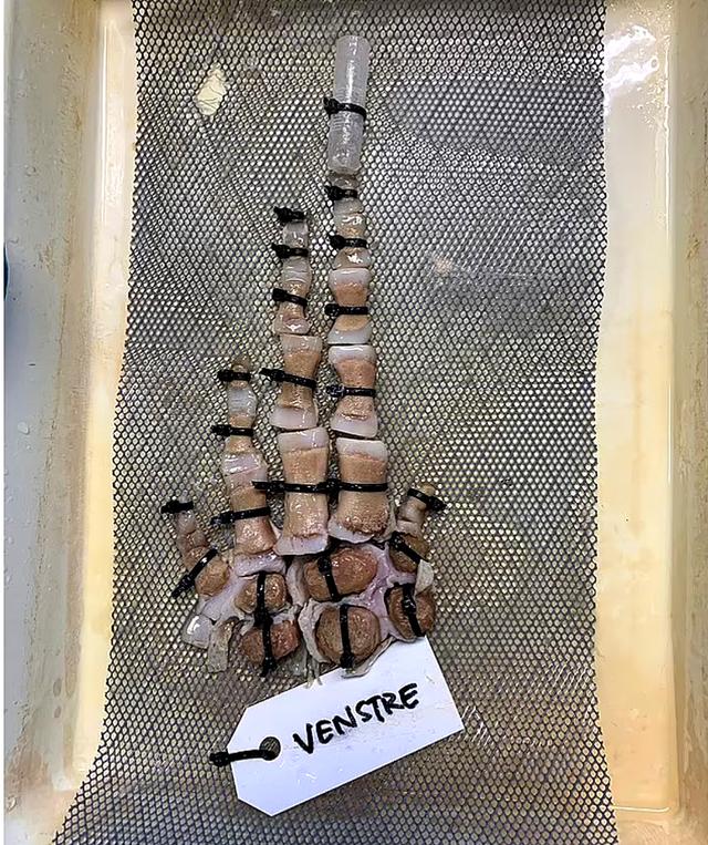 全身发抖照片,浑身发抖的图片