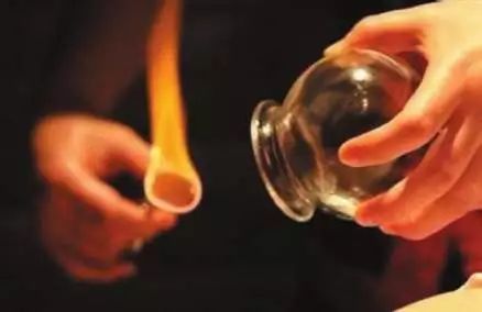 拔罐后为啥有的罐印有的深有的浅,拔罐对人是有好处还是有坏处