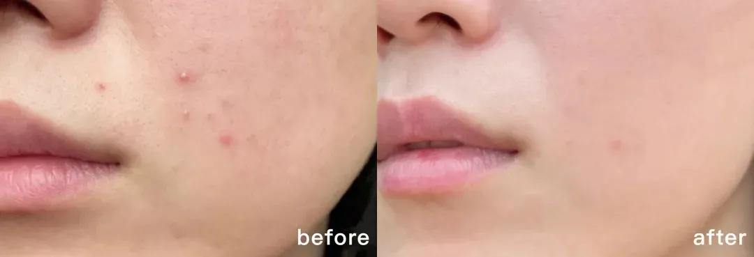 雪花秀顺行洗面奶泡沫不多,雪花秀洗面奶不起沫