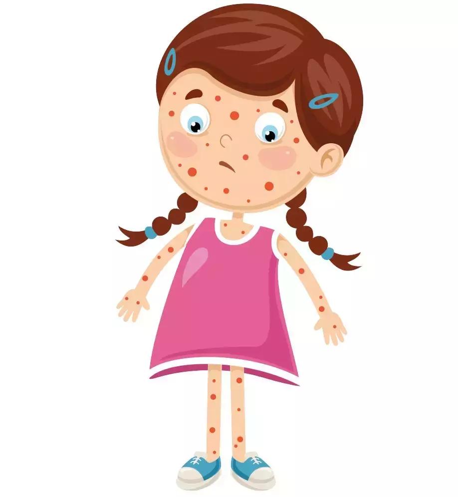 春季过敏高发外出踏青需注意防护,踏青安全教育