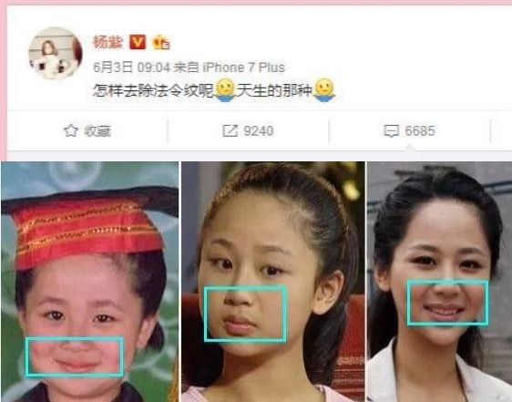 杨紫近照曝光无修图法令纹很深,杨紫面部填充法令纹