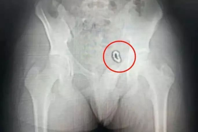 千万不要给孩子玩网红玩具,家长必须记住孩子玩的危险玩具