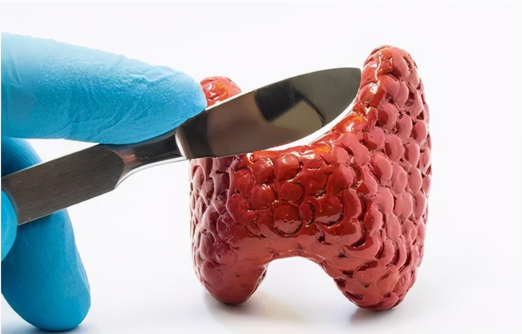 这种方法治甲状腺结节，创口只有“针眼”大