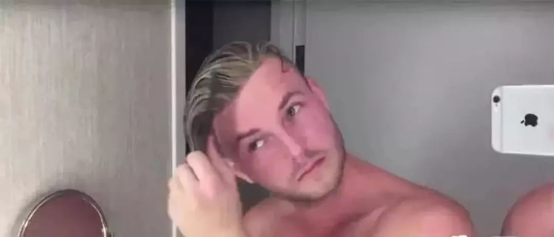 90后“未富先秃”！该拿什么拯救我的发际线？