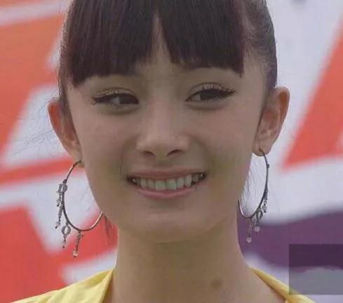 你与颜值和健康之间只差一个牙套,你与颜值巅峰只差一个发际线