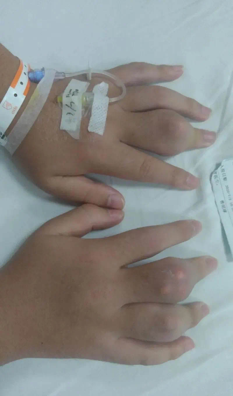 22岁的老师喝奶茶进医院,22岁女孩喝奶茶喝进icu